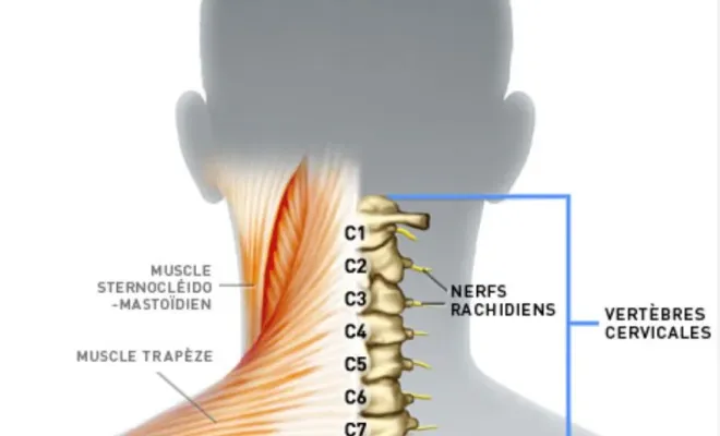 Cervicalgie à Toulouse : comprendre et soulager la douleur cervicale, Toulouse, Marion